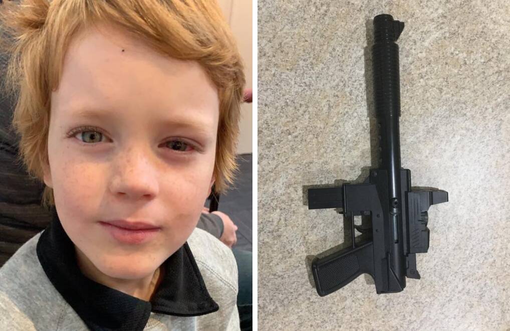 A nightmare scenario: David Benzie, 7, suffered severe eye damage after being shot with an air-powered pellet gun at the Harvey Agricultural Show. Photos: Supplied. 