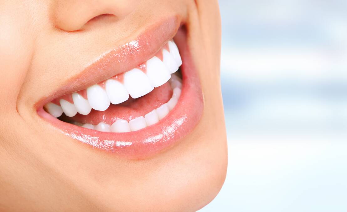 If your teeth are crooked, stained, or chipped, veneers can help improve your smile. Picture Shutterstock